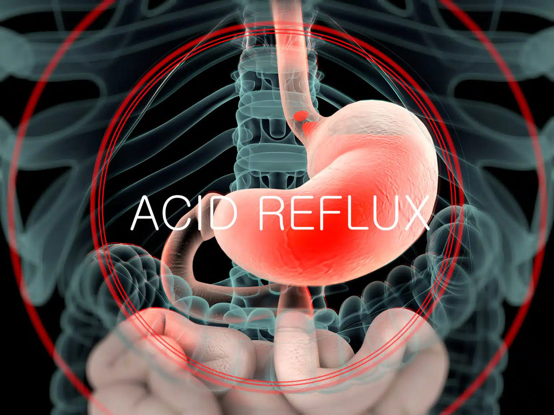Acid Reflux & Protecting Your Best Sleep